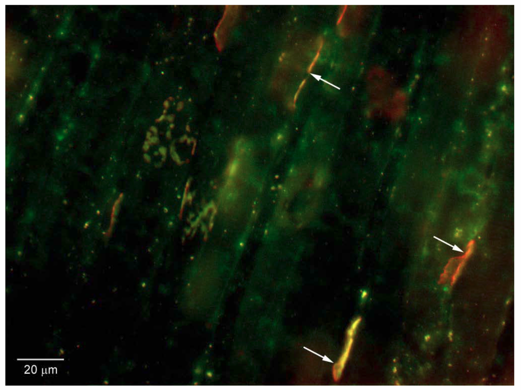 Toxins 02 02872 g006 1024