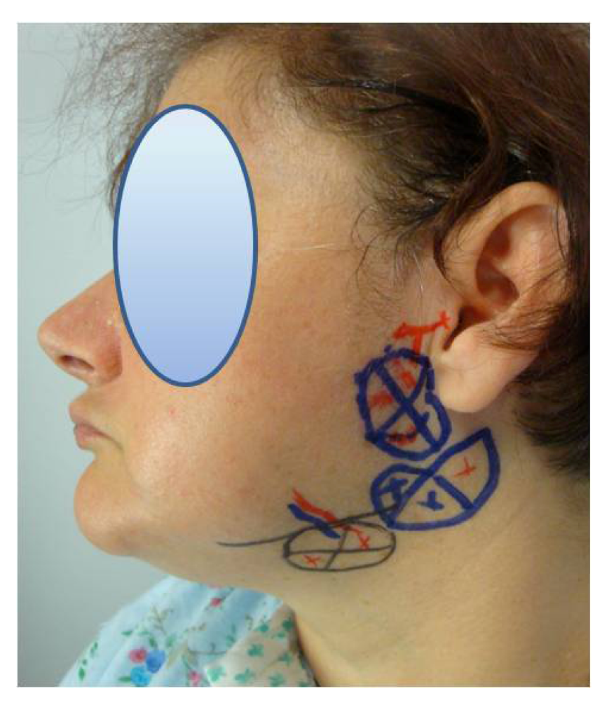 Toxins 04 00956 g002 1024