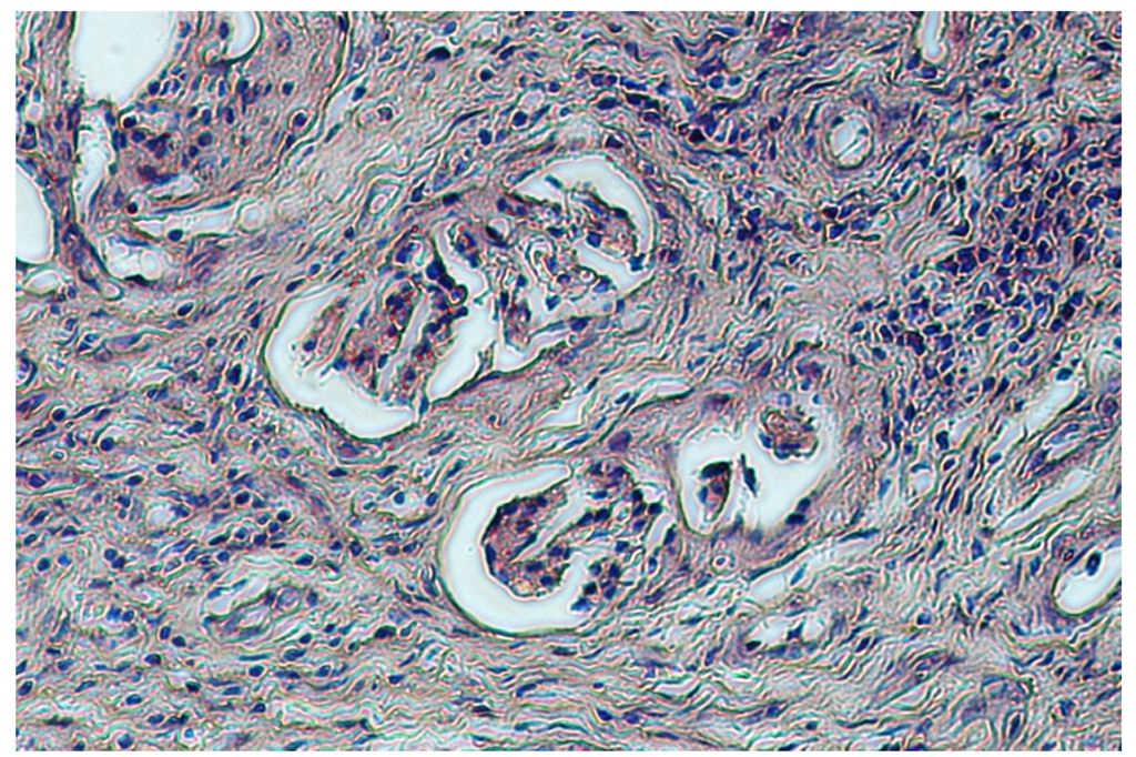 Toxins 04 01440 g002 1024