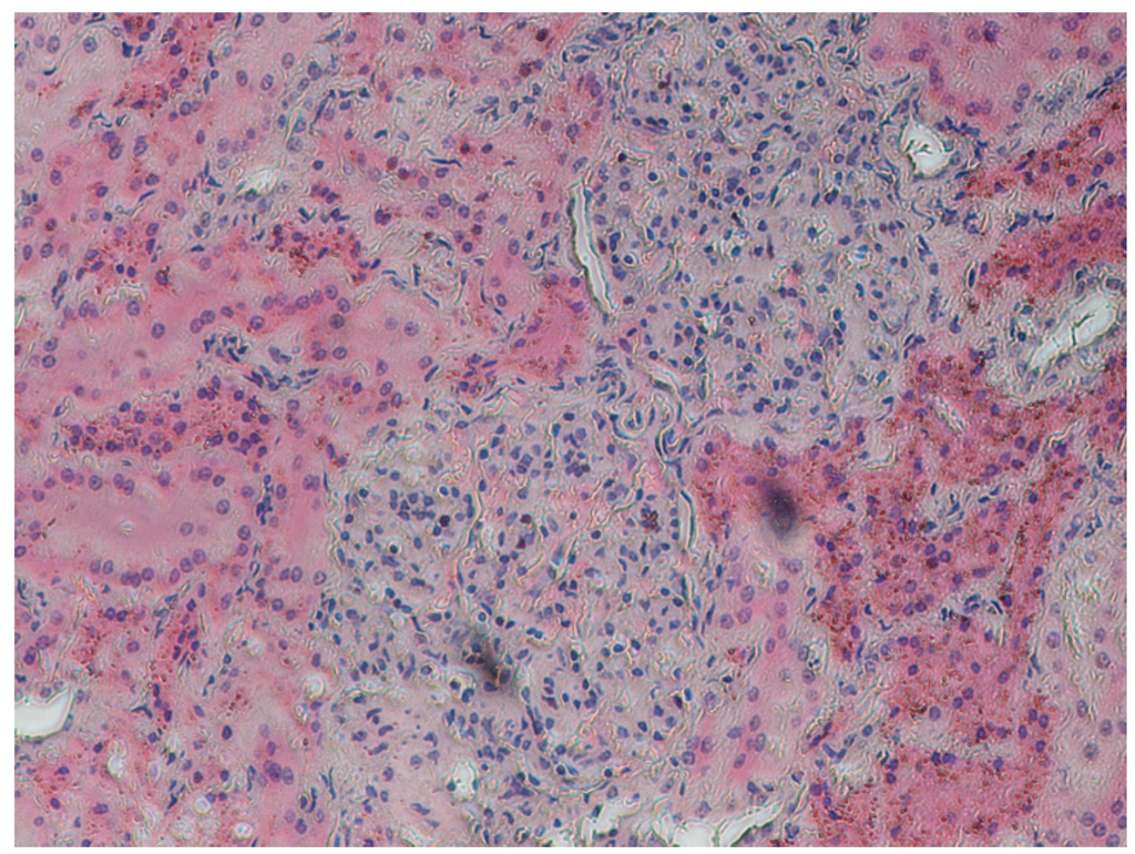 Toxins 04 01440 g003 1024