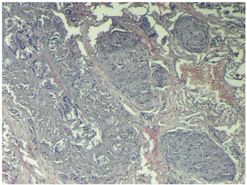 Toxins 04 01440 g005 1024