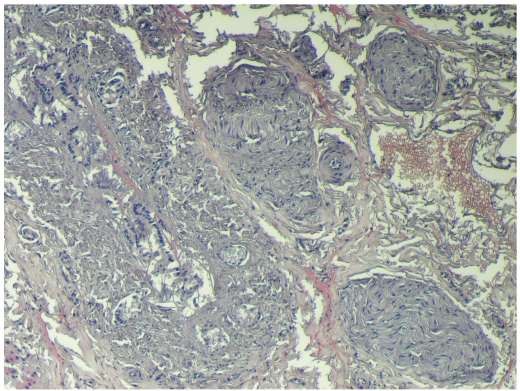 Toxins 04 01440 g005