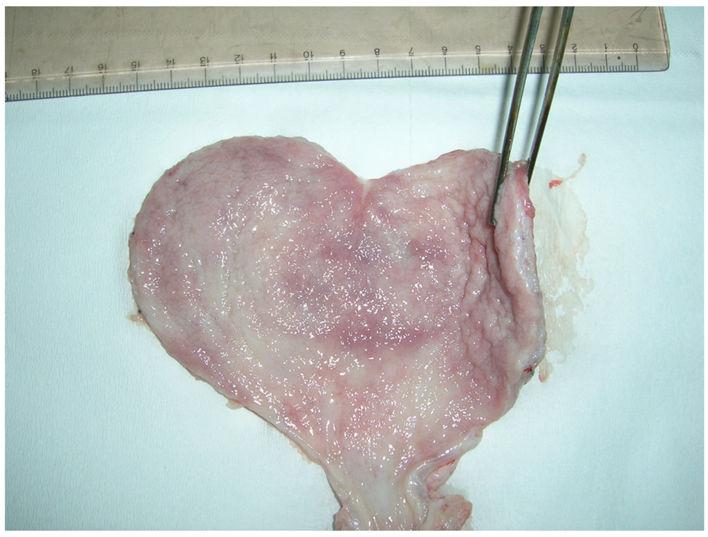 Toxins 04 01440 g006 1024