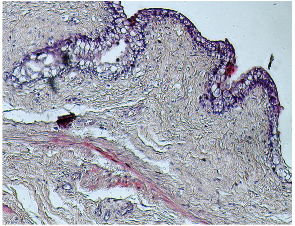 Toxins 04 01440 g007 1024