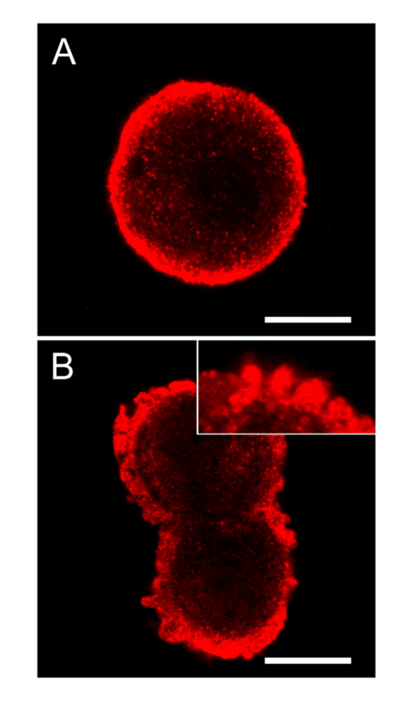 Toxins 04 01482 g008 1024