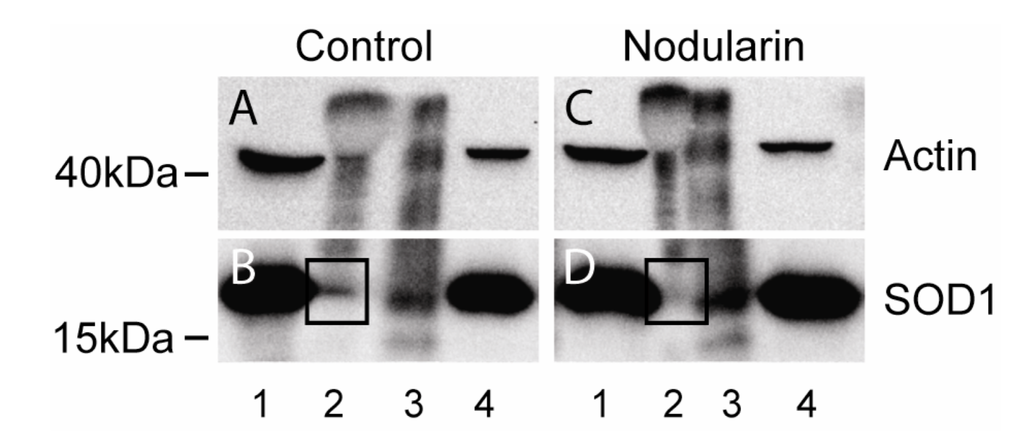 Toxins 04 01482 g011 1024