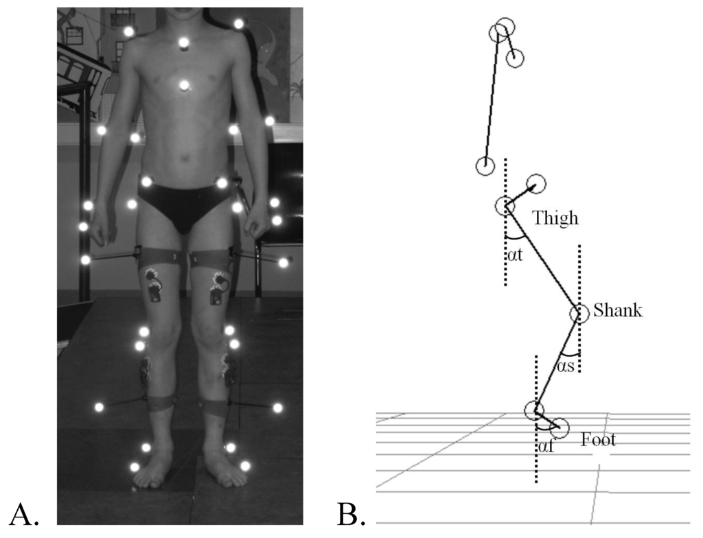 Toxins 05 00093 g003 1024