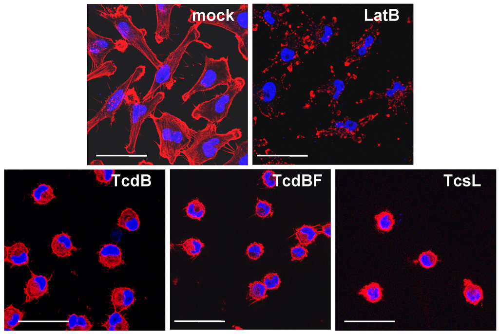 Toxins 05 00106 g001 1024