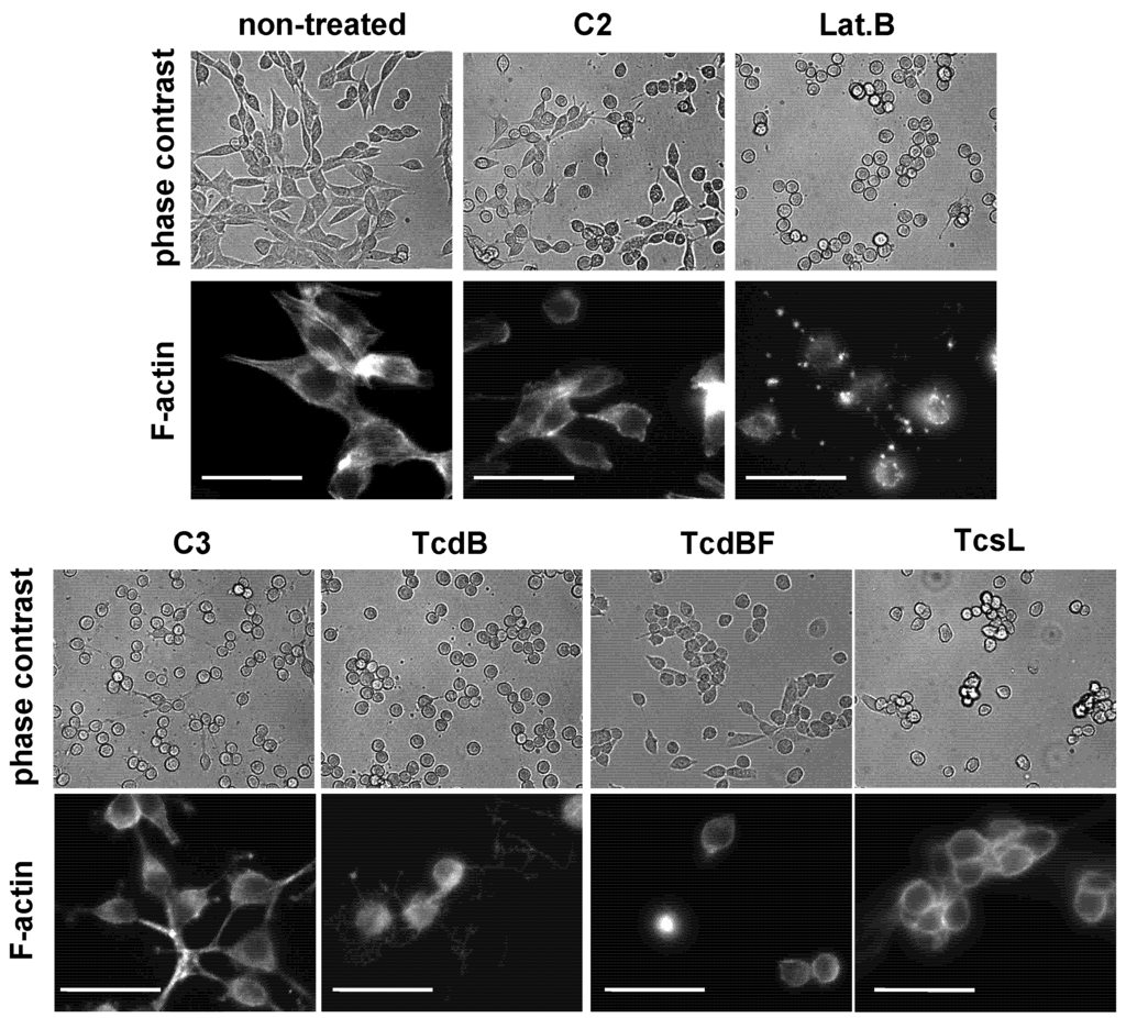 Toxins 05 00106 g004 1024