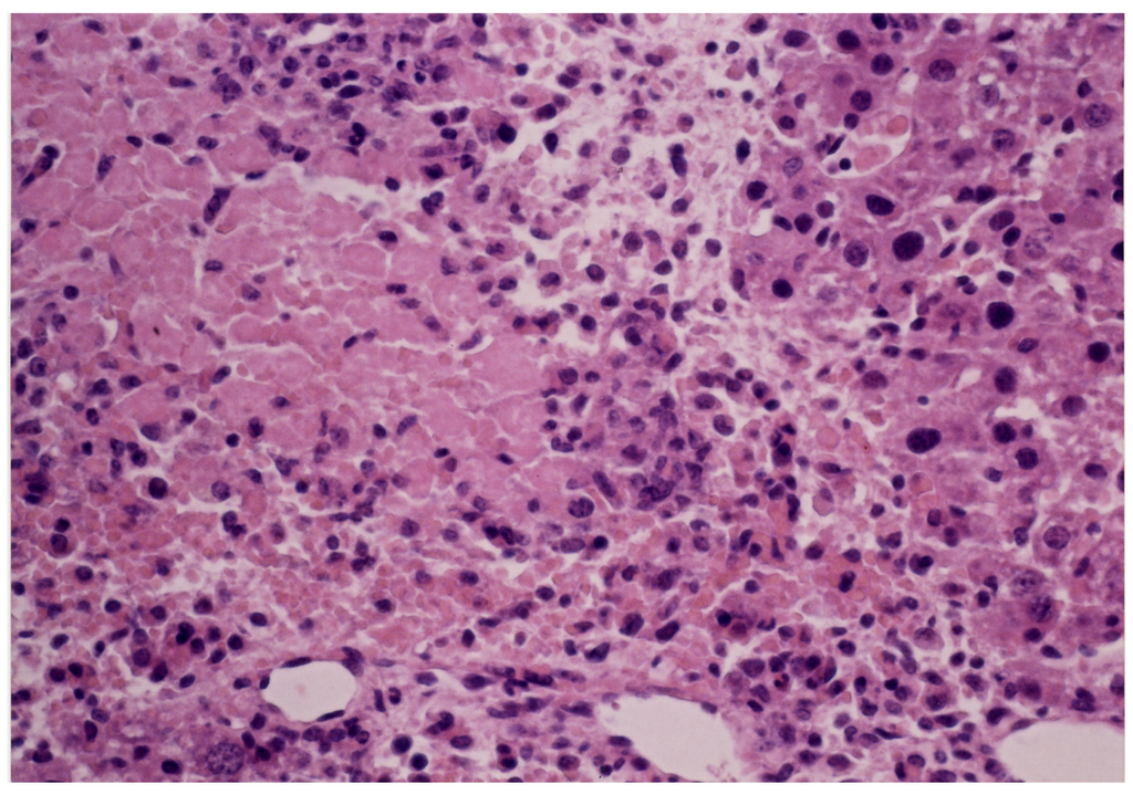 Toxins 06 00539 g009 1024