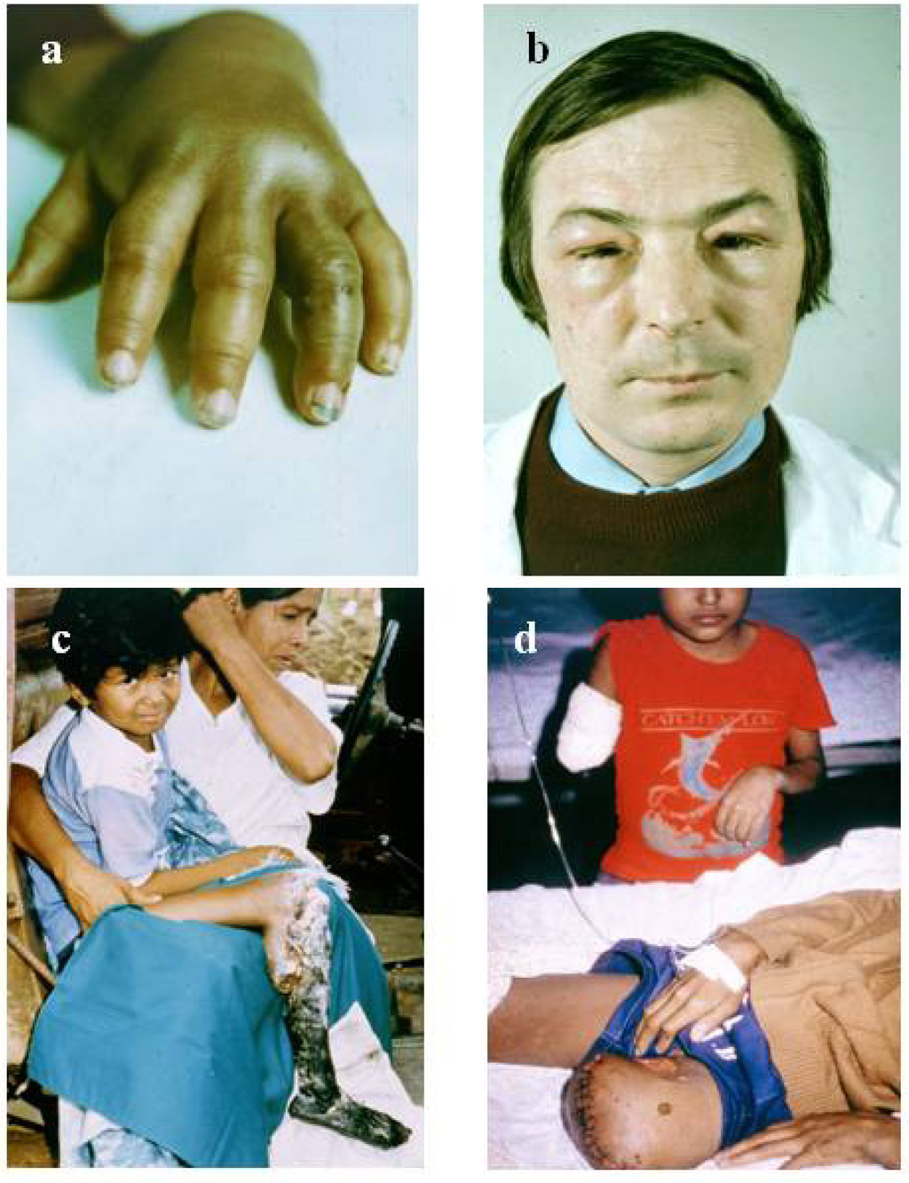 Toxins 06 01667 g001 1024