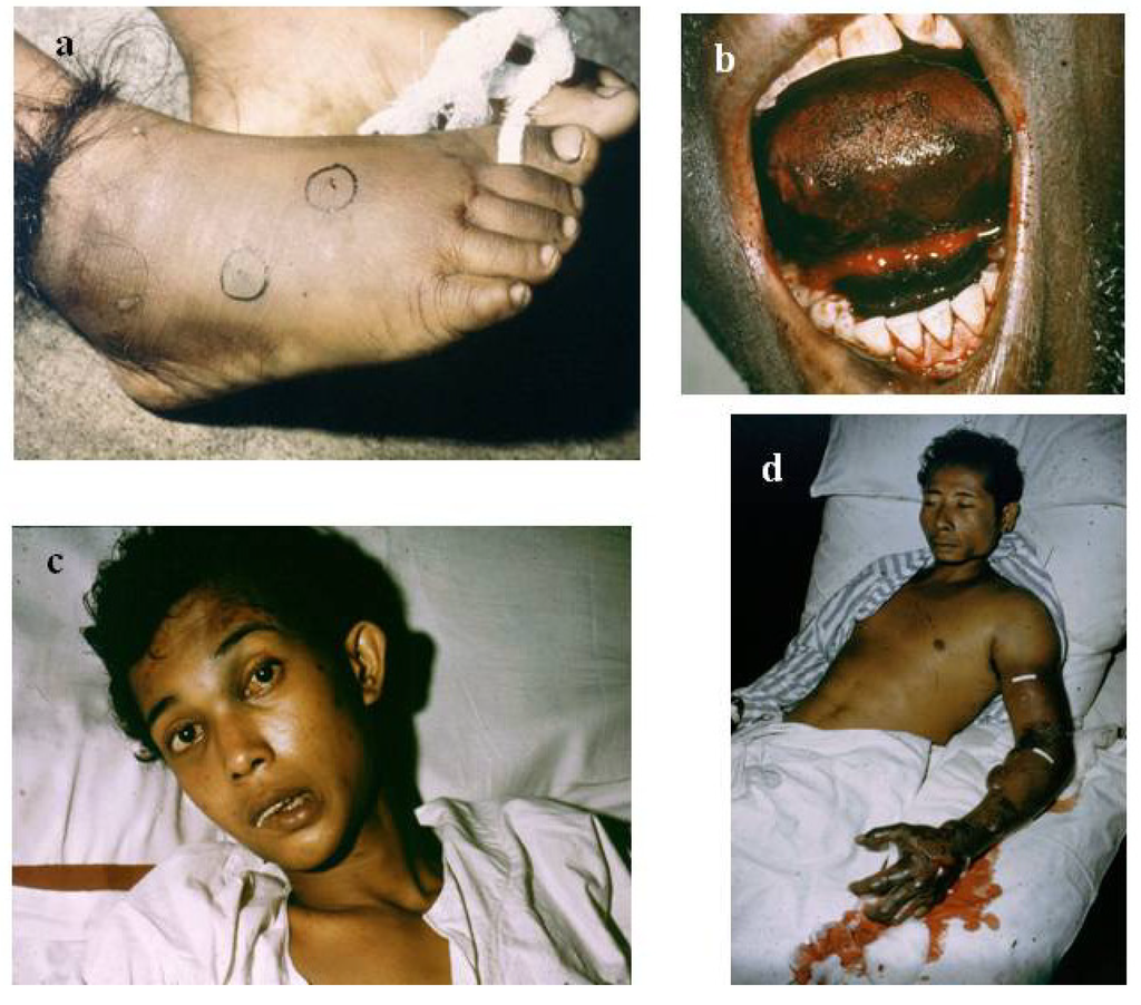 Toxins 06 01667 g002 1024