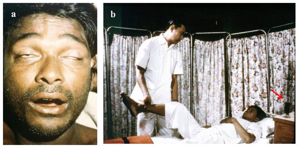 Toxins 06 01667 g003 1024