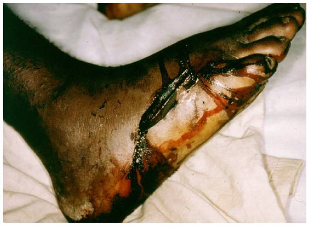 Toxins 06 01667 g015 1024