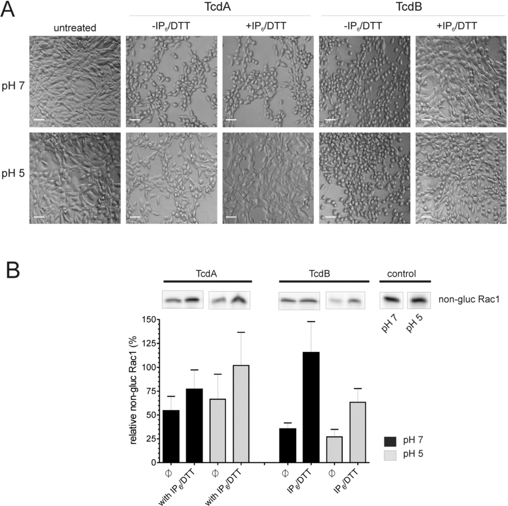 Toxins 06 02162 g008 1024