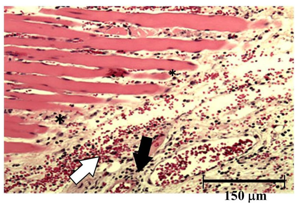 Toxins 06 02594 g006 1024