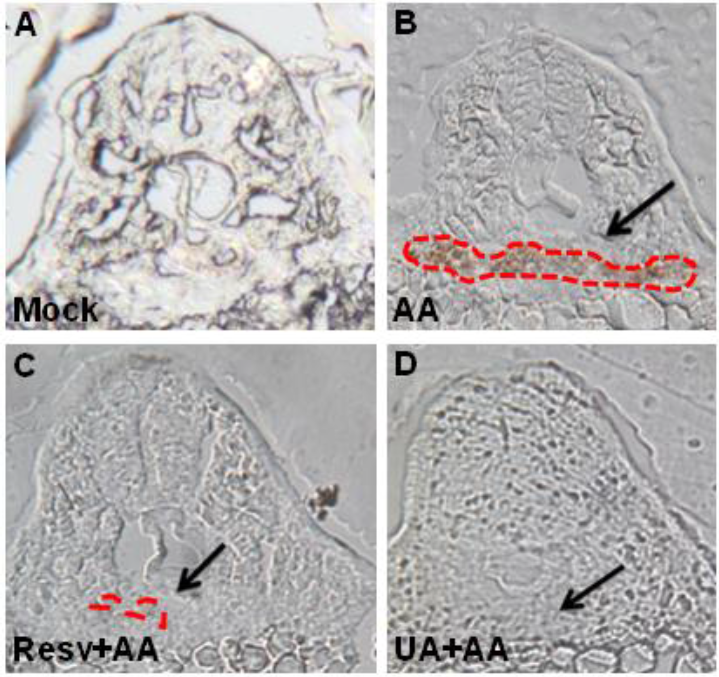 Toxins 07 00097 g005