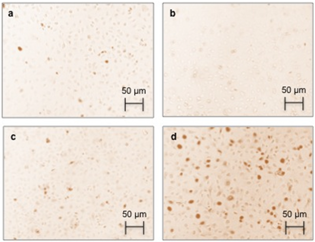 Toxins 07 01722 g002 1024