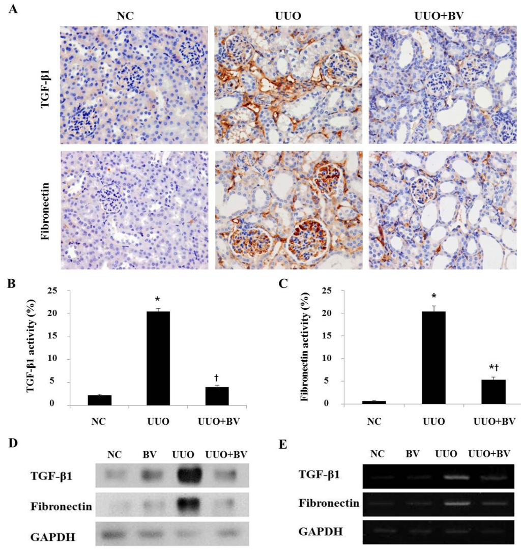 Toxins 07 01917 g003 1024