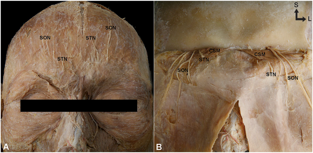 Toxins 07 02629 g003 1024
