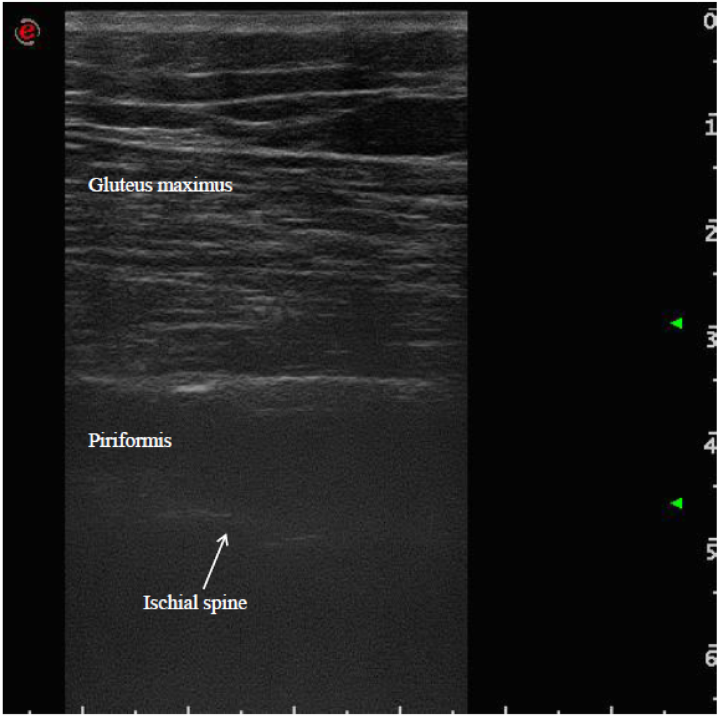 Toxins 07 03045 g002 1024