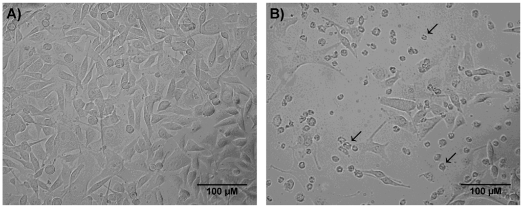 Toxins 07 03989 g002 1024