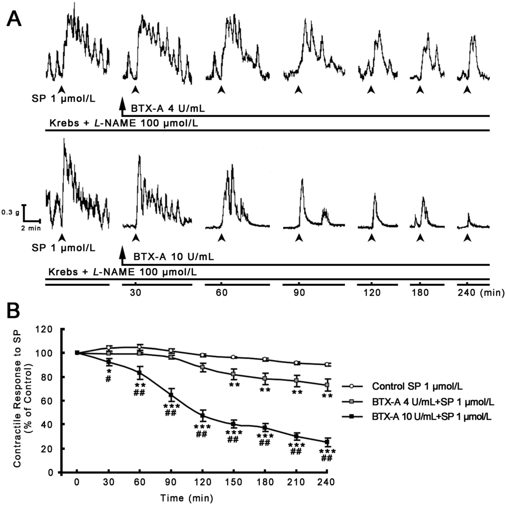 Toxins 07 04143 g003 1024