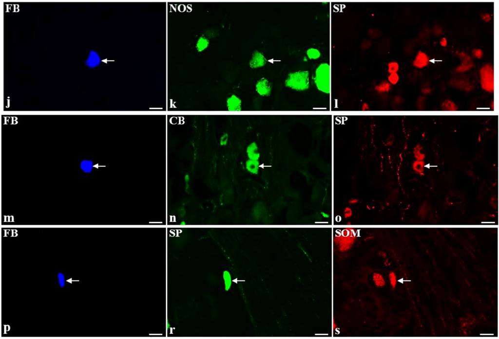 Toxins 07 04797 g001b 1024