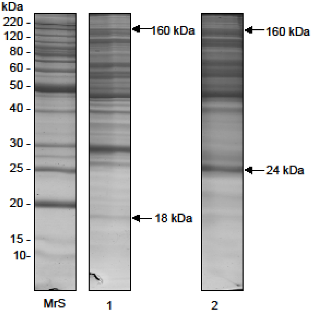 Toxins 07 04869 g001 1024