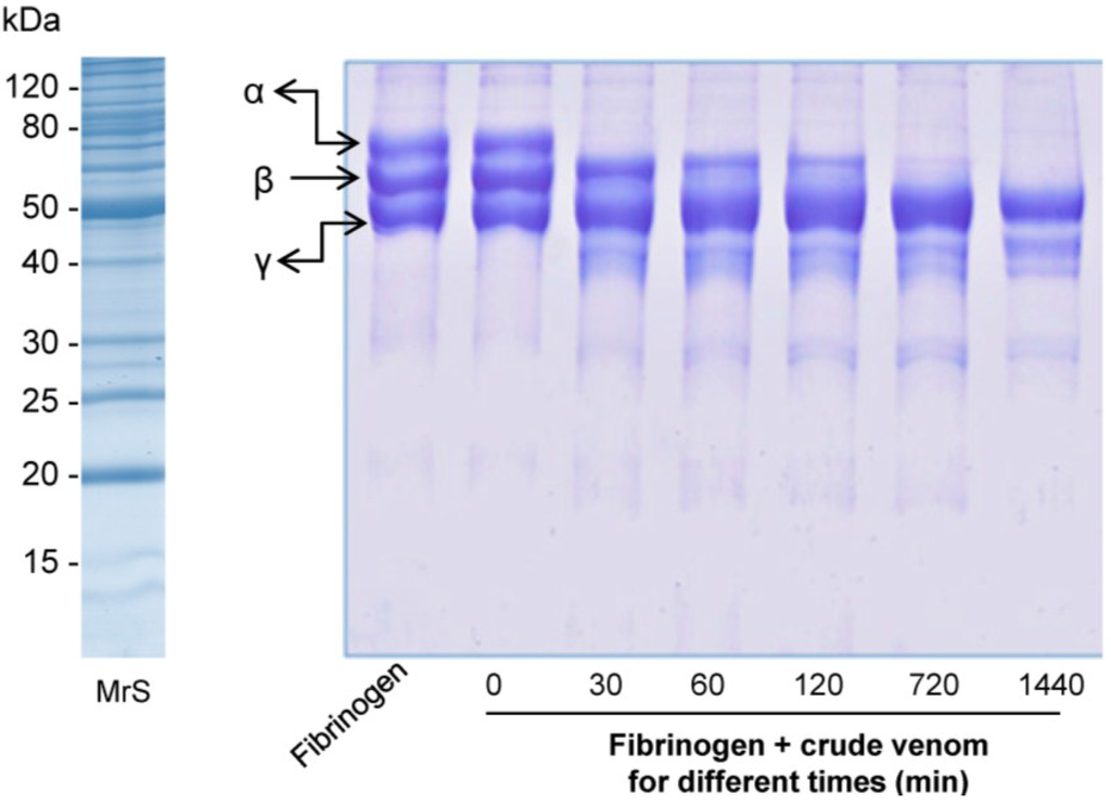 Toxins 07 04869 g005 1024