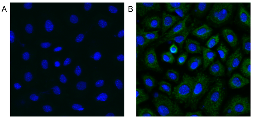 Toxins 07 04872 g006 1024