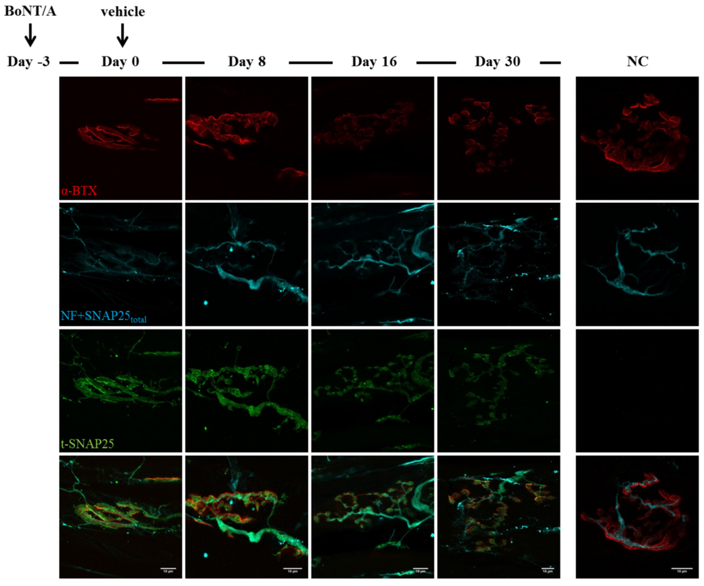 Toxins 07 04887 g003 1024