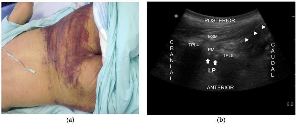 Toxins 08 00018 g002 1024