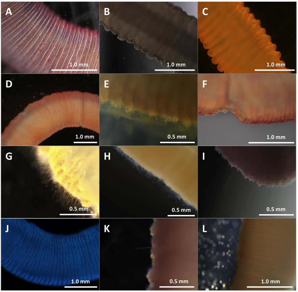 Toxins 08 00019 g005 1024