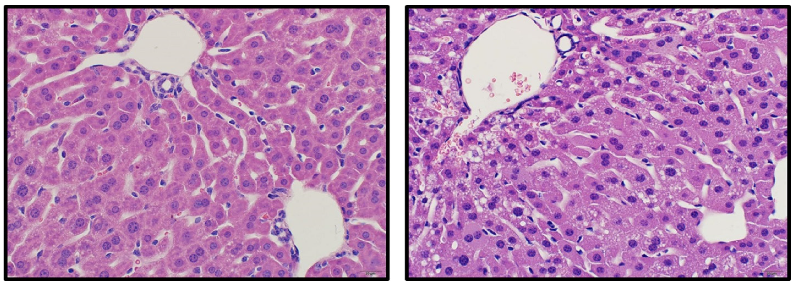 Toxins 08 00158 g004