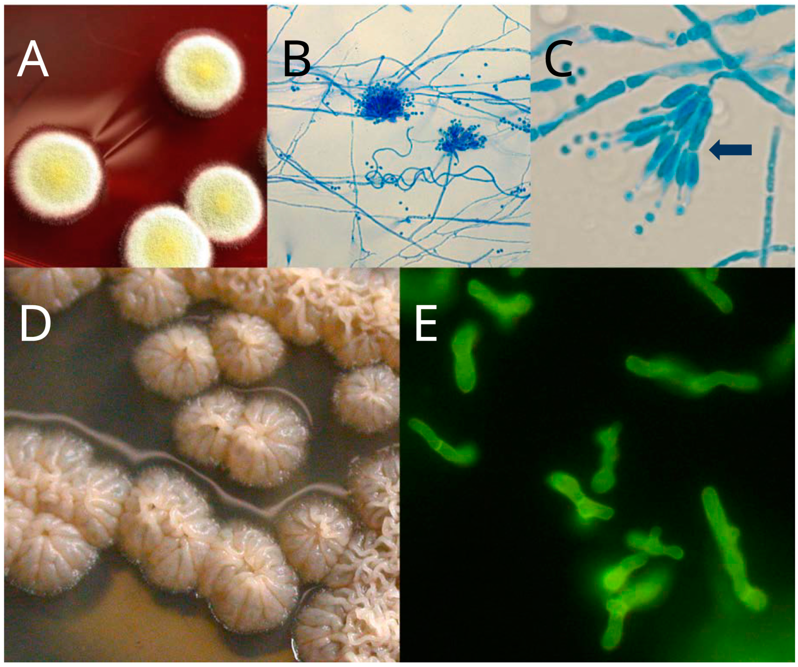 Toxins 09 00192 g001
