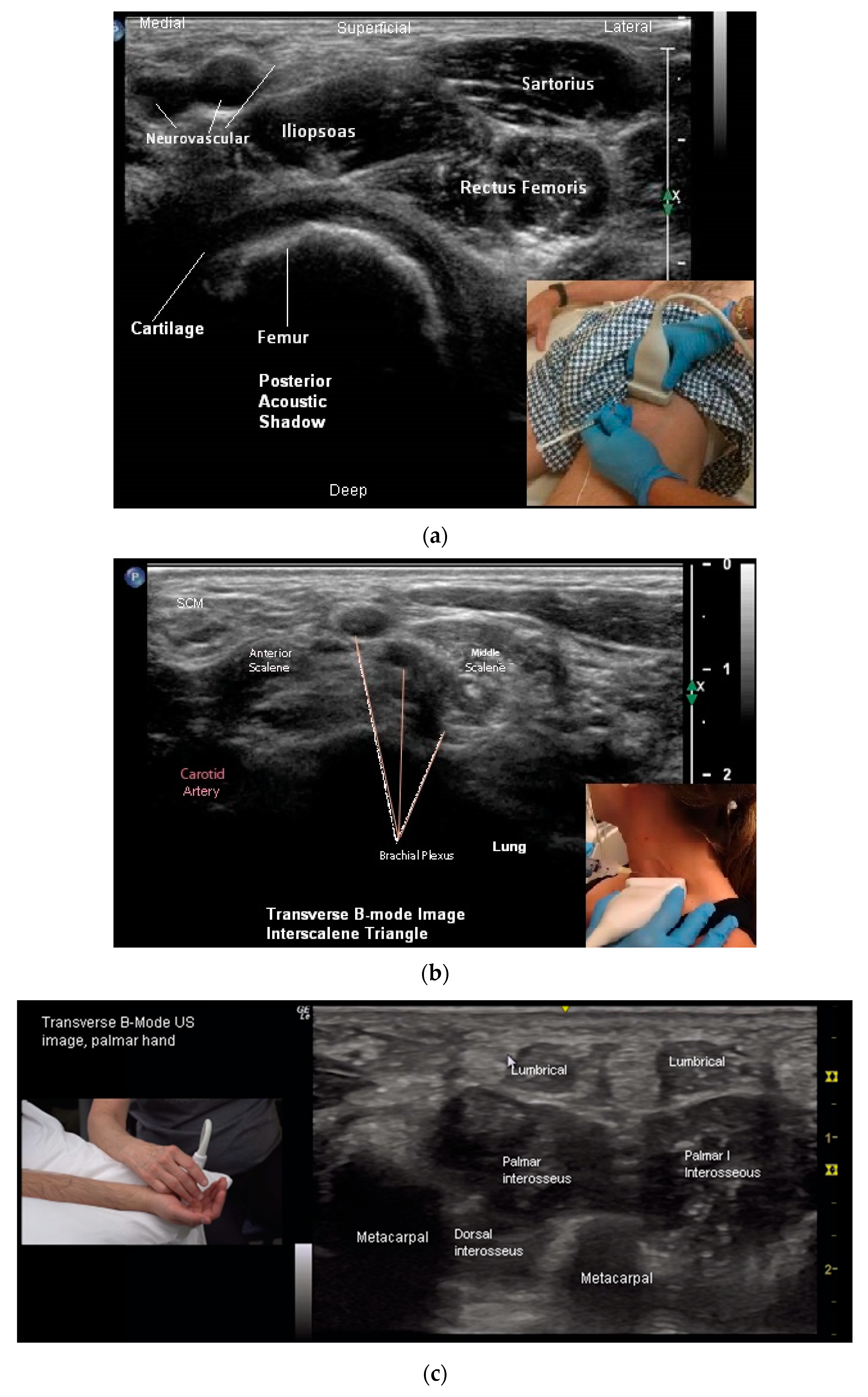 Toxins 10 00018 g005a Toxins 10 00018 g005a