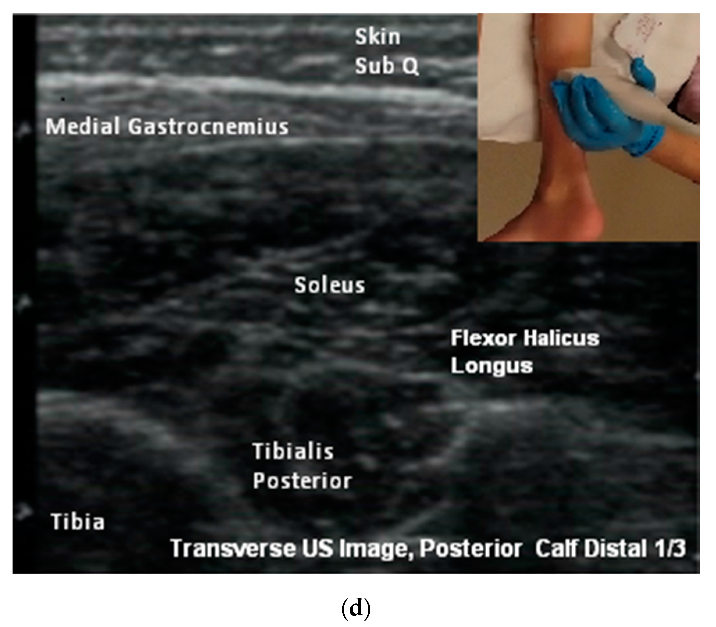 Toxins 10 00018 g005b Toxins 10 00018 g005b