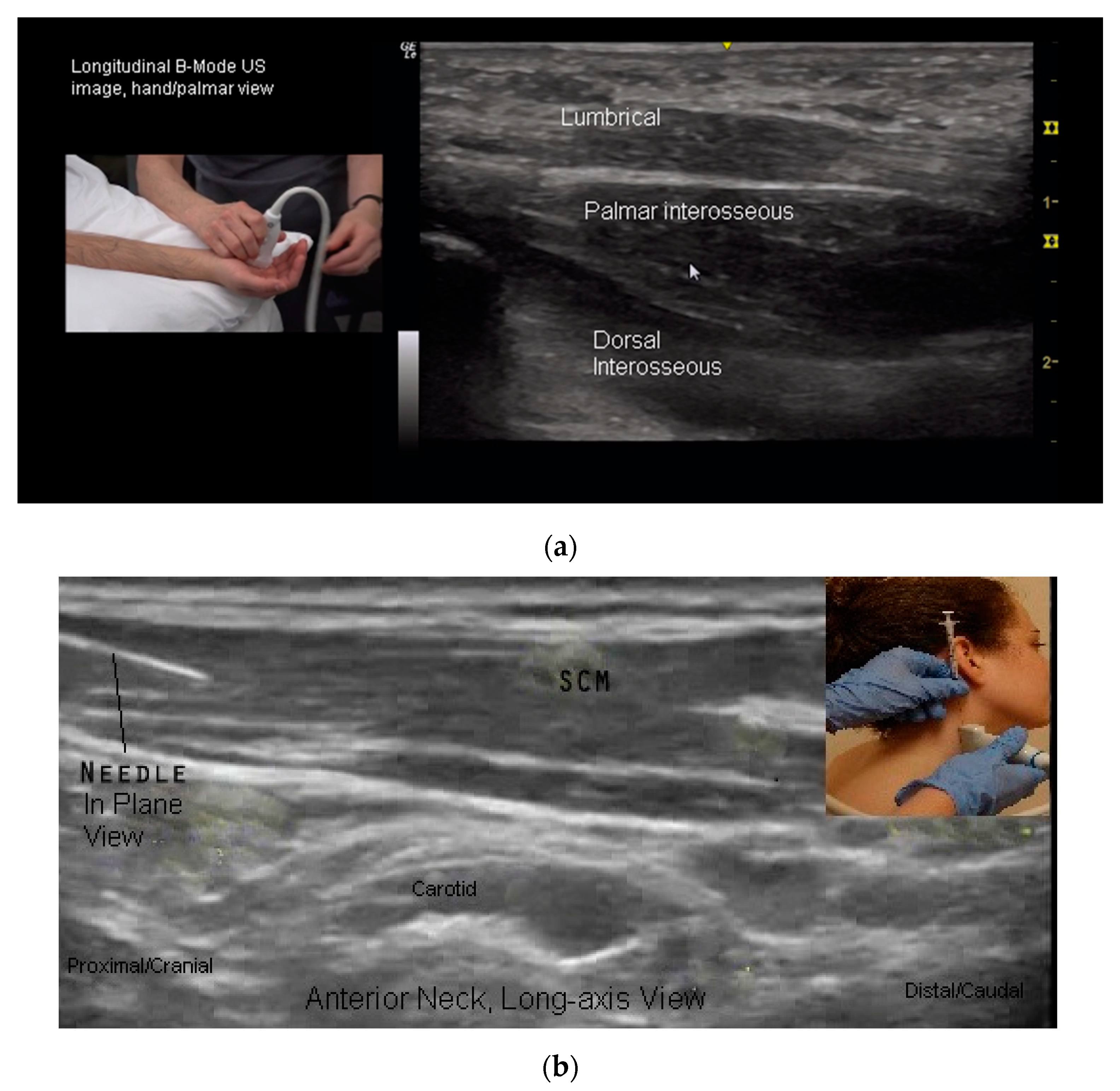 Toxins 10 00018 g006a Toxins 10 00018 g006a