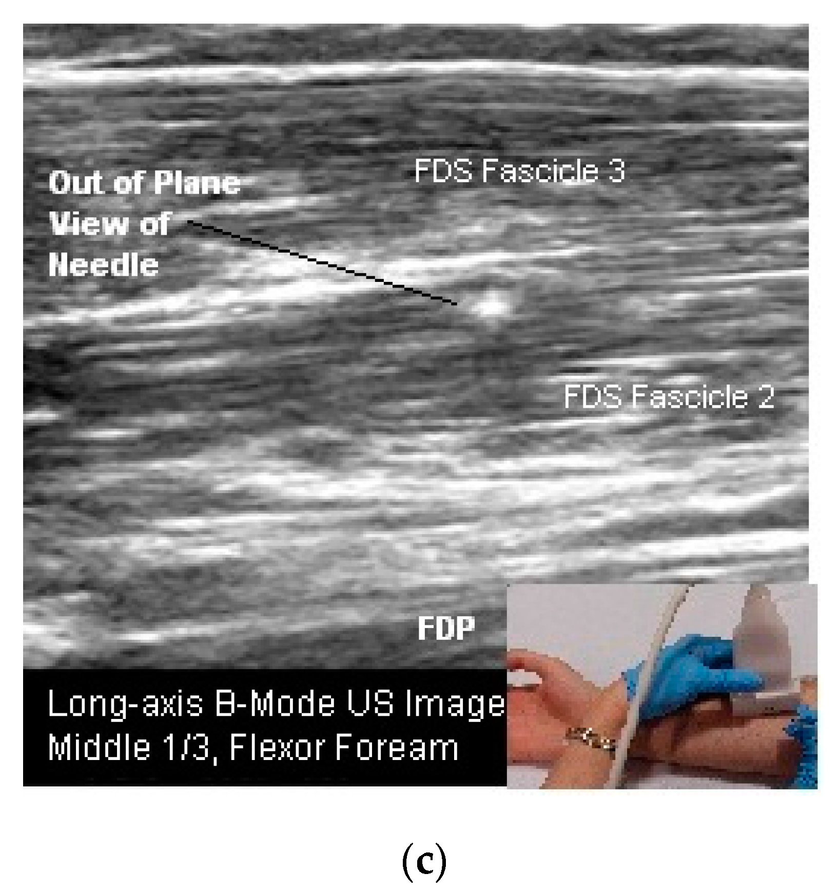 Toxins 10 00018 g006b Toxins 10 00018 g006b