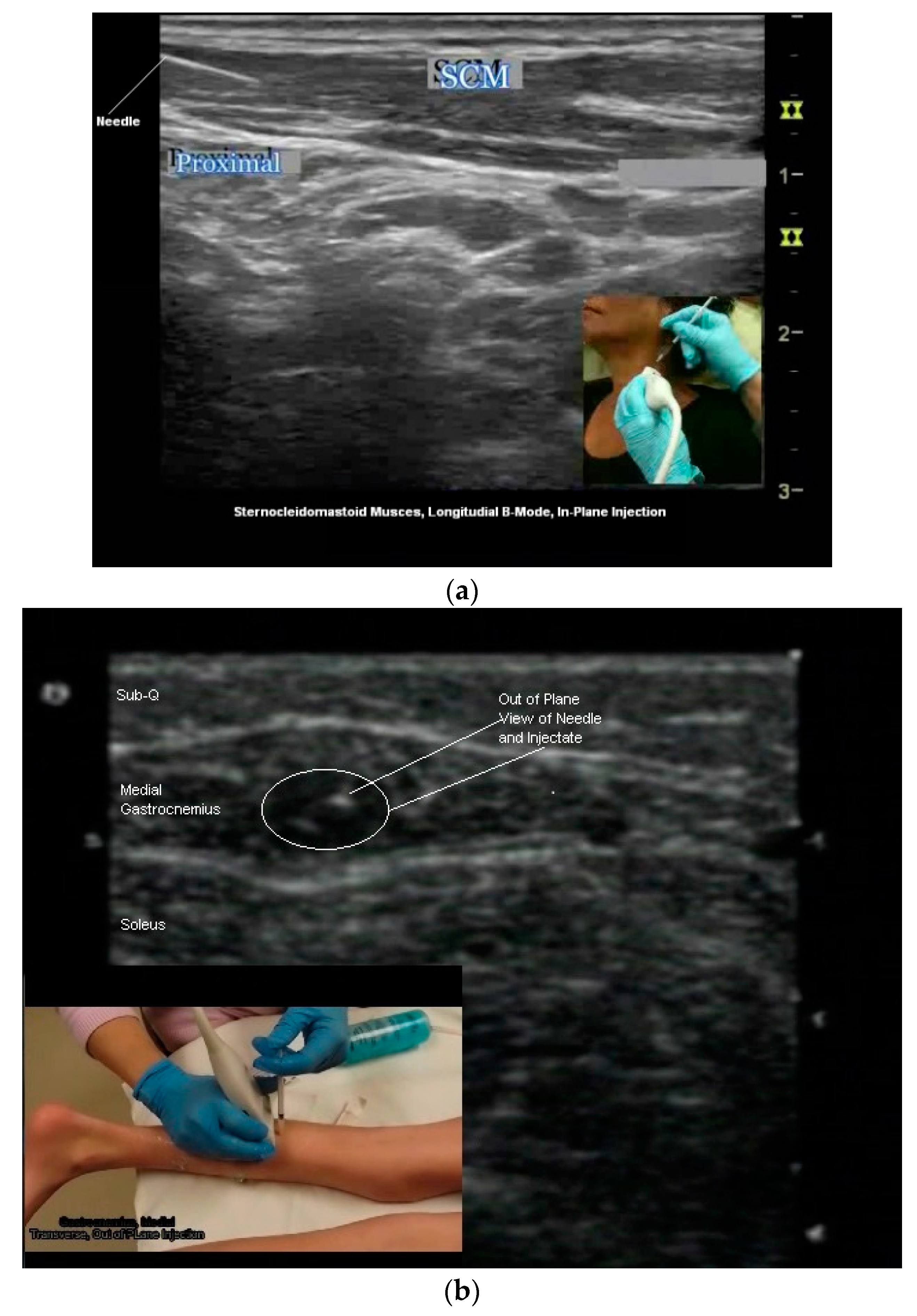 Toxins 10 00018 g007a Toxins 10 00018 g007a