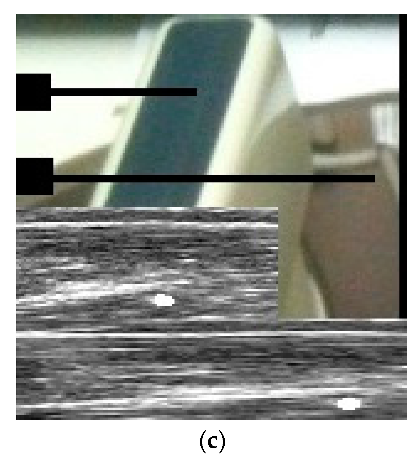 Toxins 10 00018 g007b Toxins 10 00018 g007b