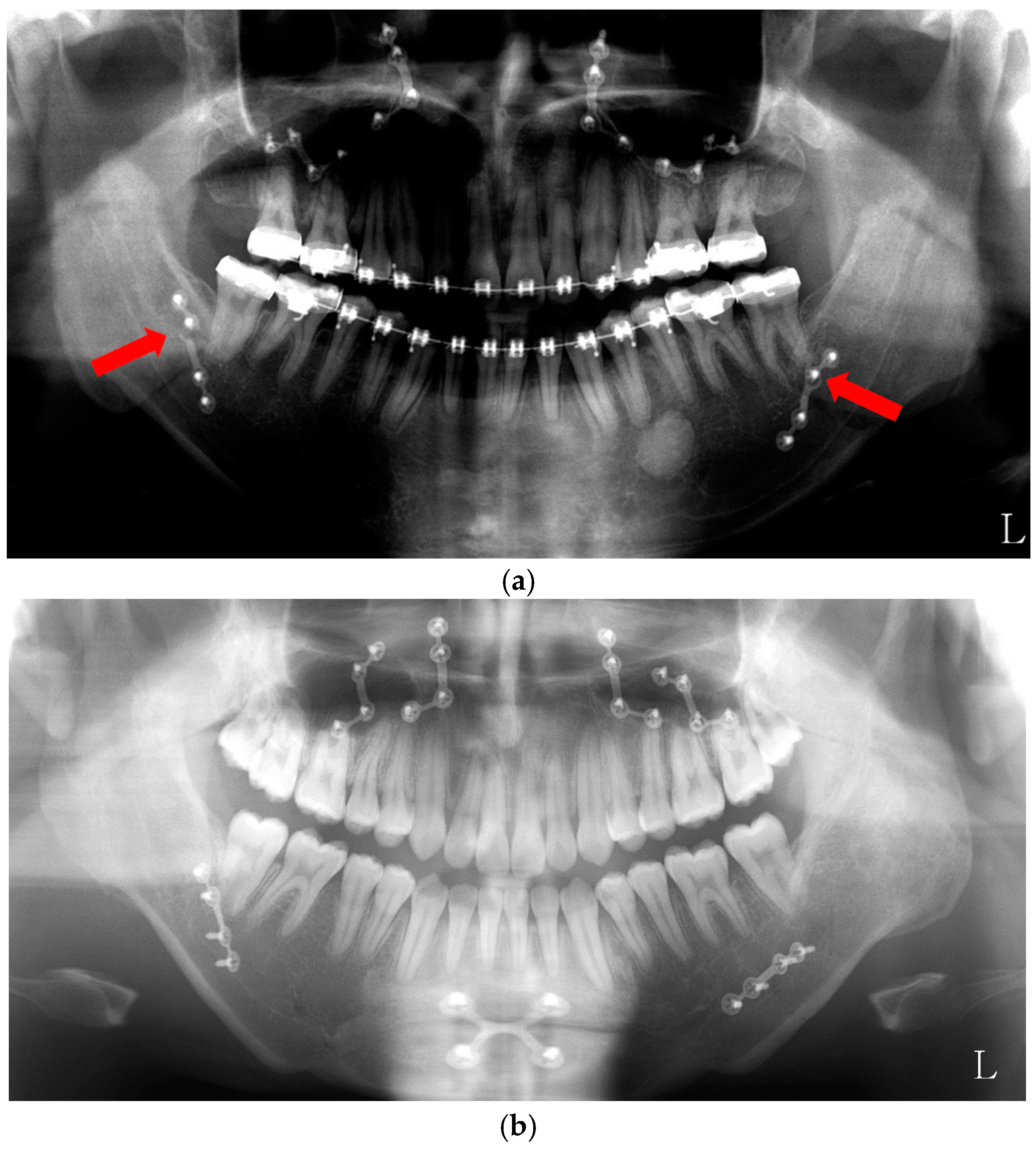 Toxins 10 00027 g005 Toxins 10 00027 g005