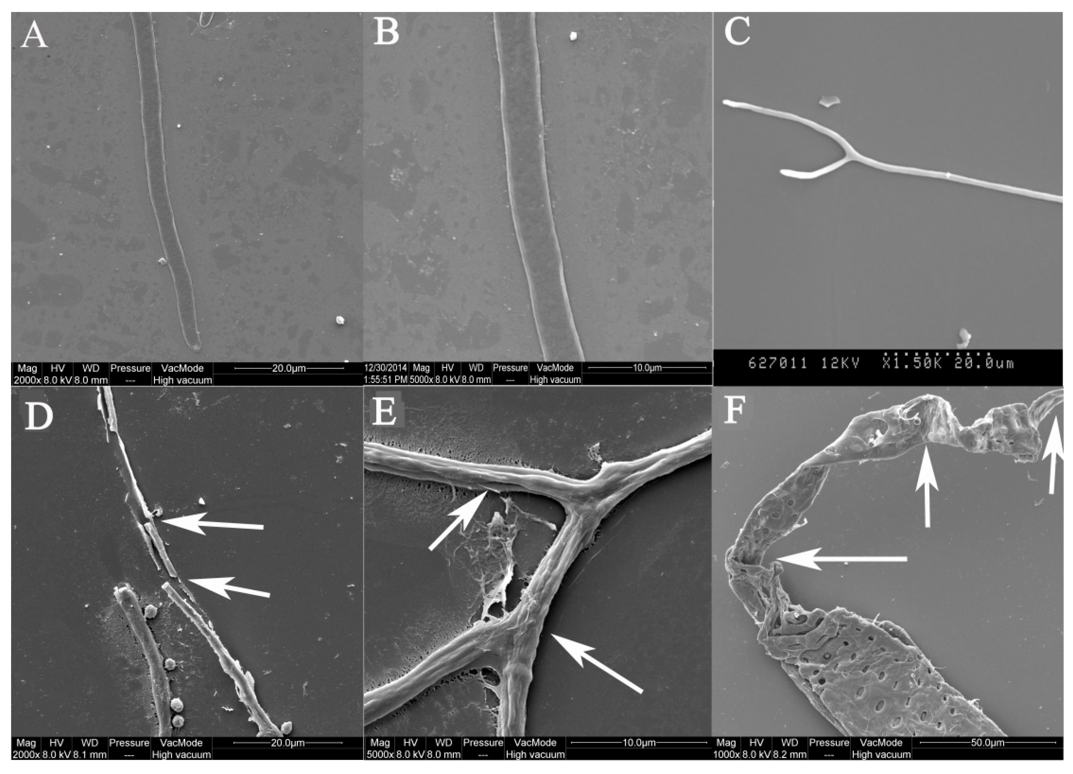 Toxins 10 00340 g002