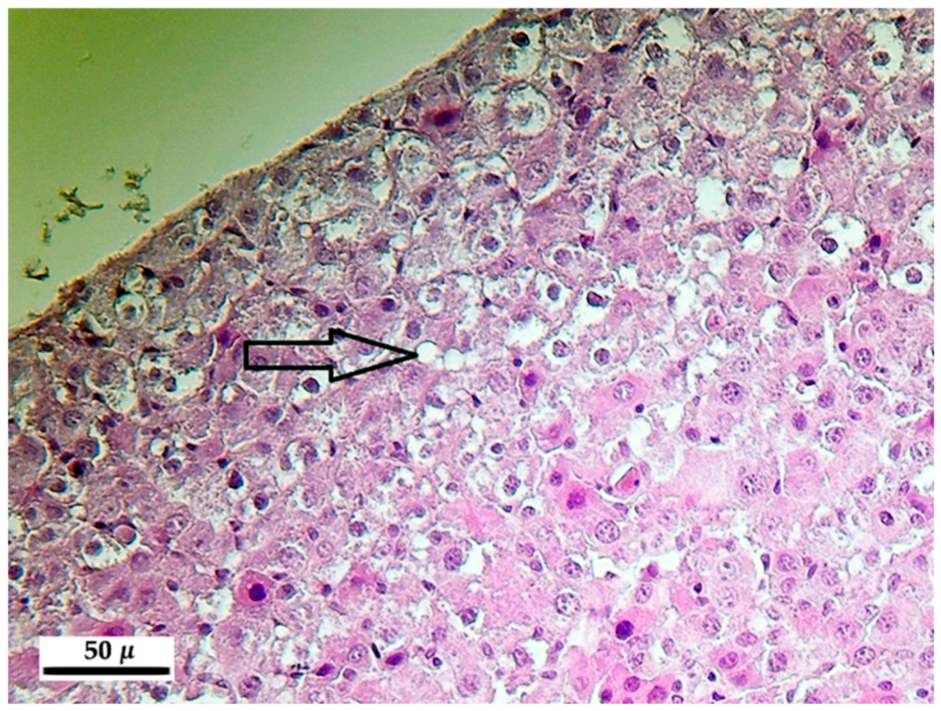 Toxins 10 00465 g001 Toxins 10 00465 g001