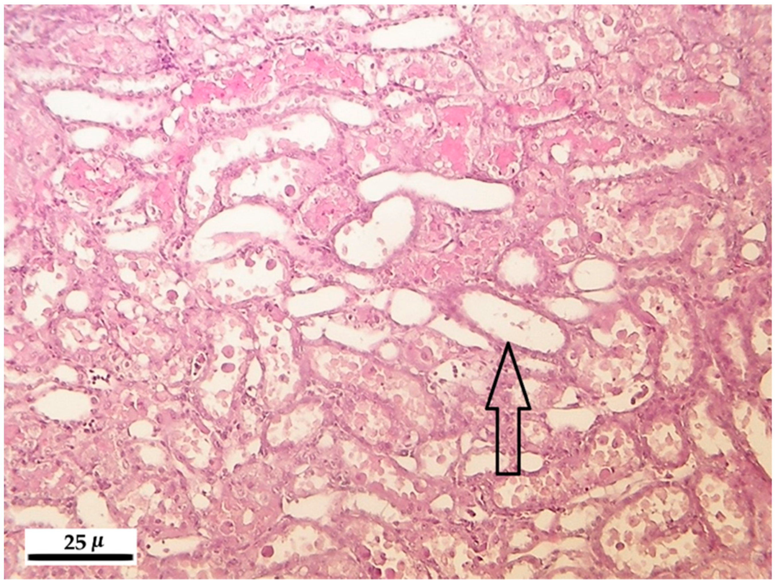 Toxins 10 00465 g004 Toxins 10 00465 g004