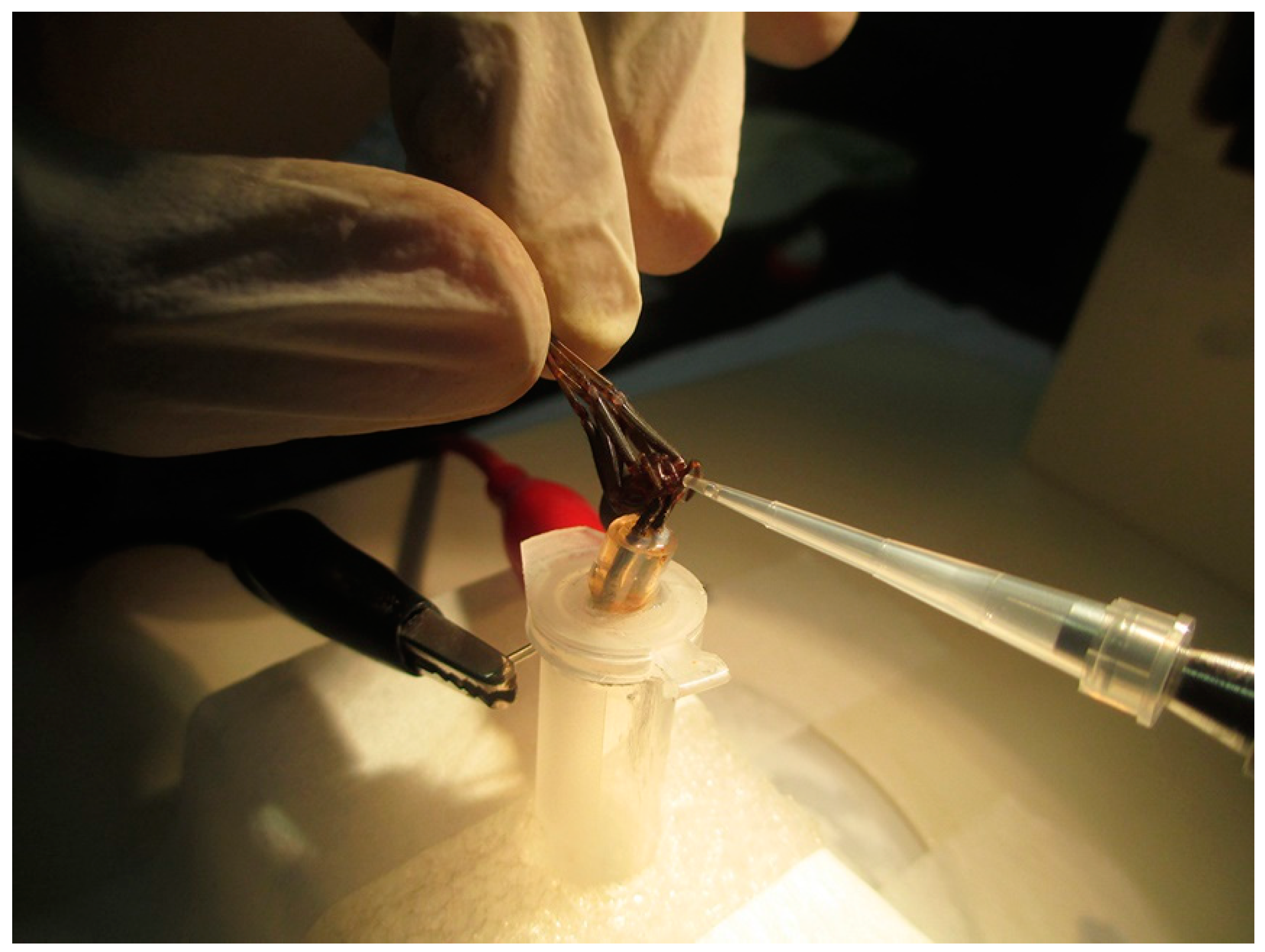 Toxins 10 00522 g010