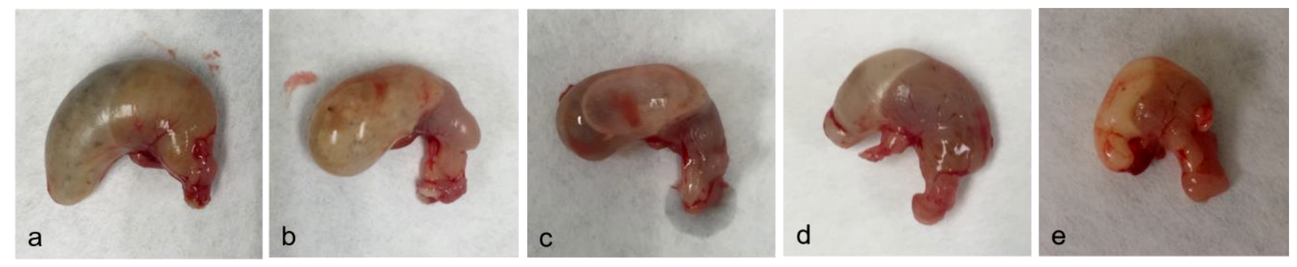 Toxins 11 00305 g002