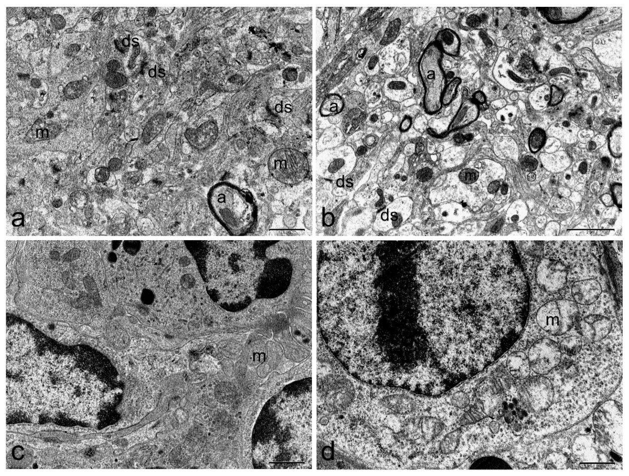 Toxins 11 00305 g005