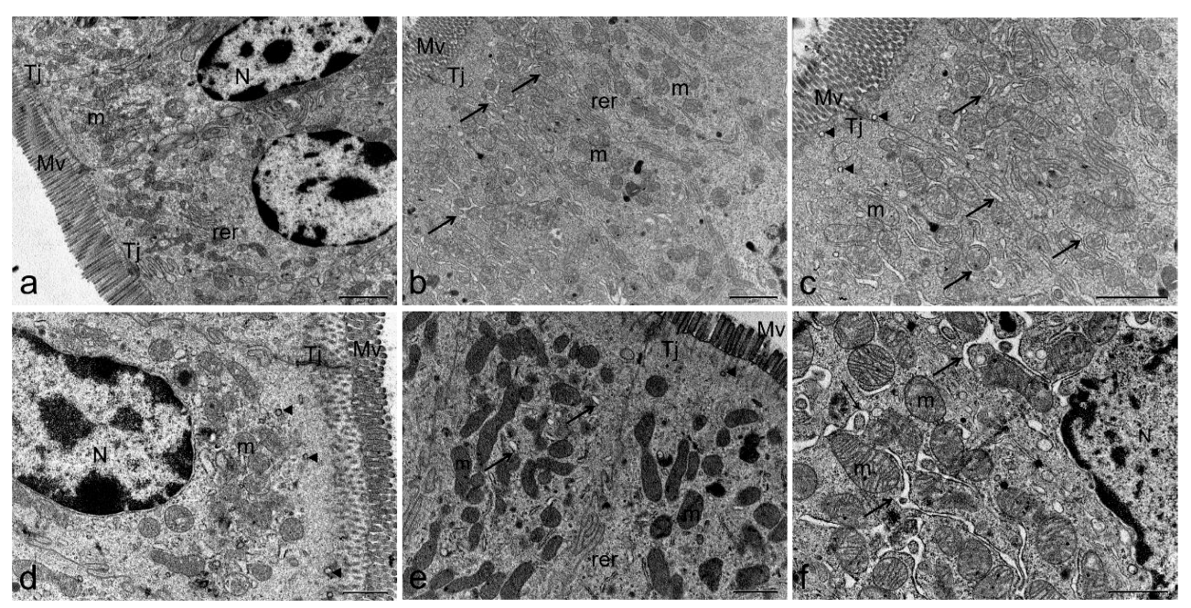 Toxins 11 00305 g007